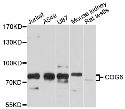 Western blot analysis of extracts of various cell lines, using Anti-COG6 Antibody (A10319) at 1:1,000 dilution.
Secondary antibody: Goat Anti-Rabbit IgG (H+L) (HRP) (AS014) at 1:10,000 dilution.
Lysates / proteins: 25µg per lane.
Blocking buffer: 3% non-fat dry milk in TBST.
Detection: ECL Basic Kit (RM00020).
Exposure time: 10s.