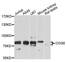 Western Blot - Anti-COG6 Antibody (A12891) - Antibodies.com