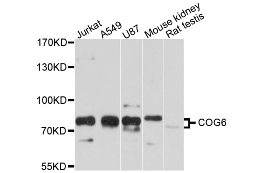 Western Blot - Anti-COG6 Antibody (A10319) - Antibodies.com