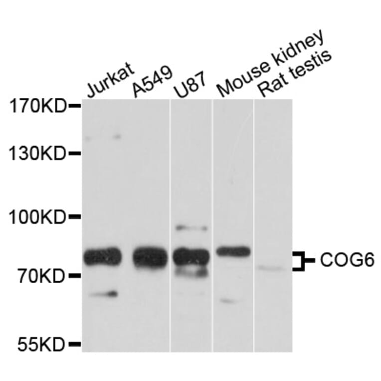 Western Blot - Anti-COG6 Antibody (A10319) - Antibodies.com