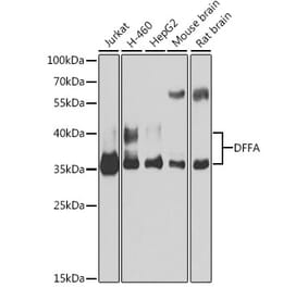 Western Blot - Anti-ICAD Antibody (A12892) - Antibodies.com