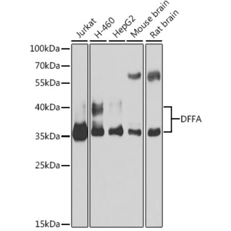 Western Blot - Anti-ICAD Antibody (A12892) - Antibodies.com