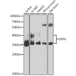 Western Blot - Anti-ICAD Antibody (A12892) - Antibodies.com