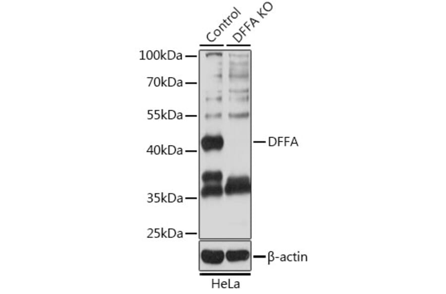 Western Blot - Anti-ICAD Antibody (A12892) - Antibodies.com