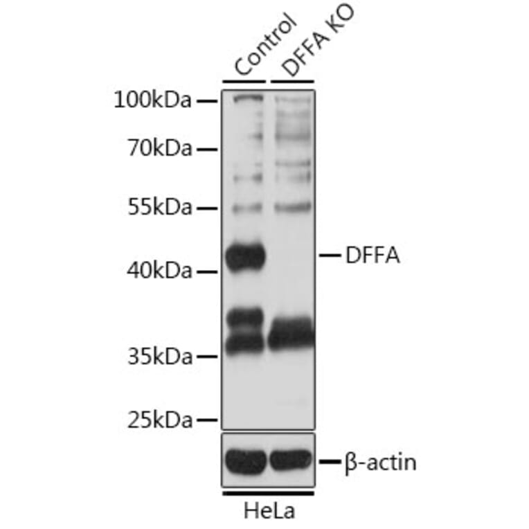 Western Blot - Anti-ICAD Antibody (A12892) - Antibodies.com