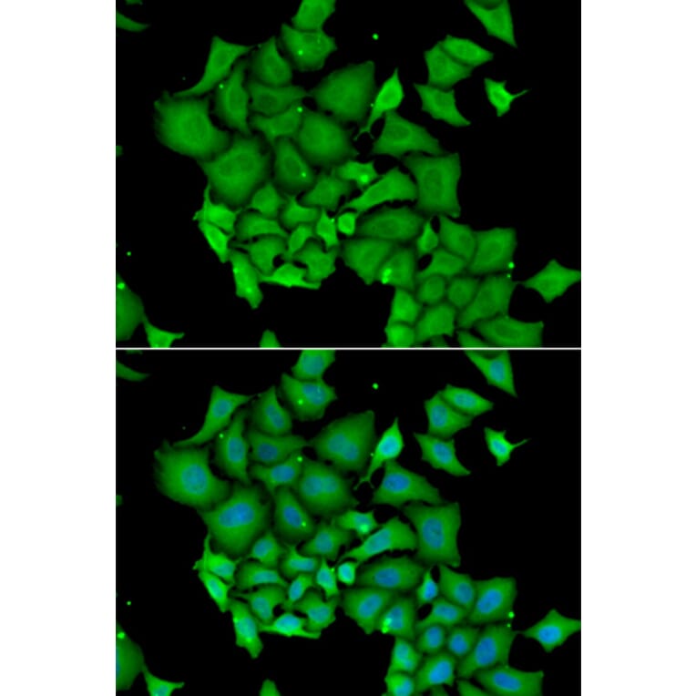 Immunofluorescence - Anti-ICAD Antibody (A12892) - Antibodies.com