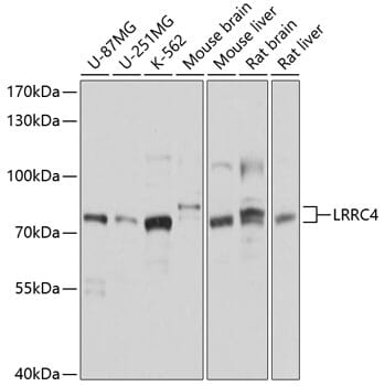 Western blot analysis of extracts of various cell lines, using Anti-LRRC4 Antibody (A10321) at 1:1,000 dilution.
Secondary antibody: Goat Anti-Rabbit IgG (H+L) (HRP) (AS014) at 1:10,000 dilution.
Lysates / proteins: 25µg per lane.
Blocking buffer: 3% non-fat dry milk in TBST.
Detection: ECL Basic Kit (RM00020).
Exposure time: 1s.