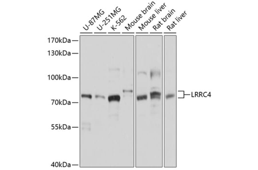 Western Blot - Anti-LRRC4 Antibody (A12893) - Antibodies.com