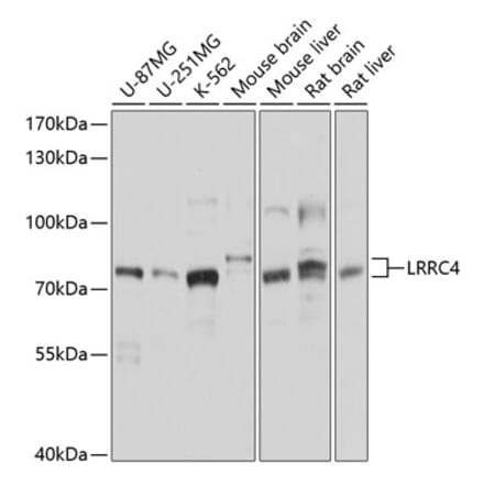 Western Blot - Anti-LRRC4 Antibody (A12893) - Antibodies.com