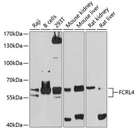 Western Blot - Anti-FCRL4 Antibody (A12895) - Antibodies.com