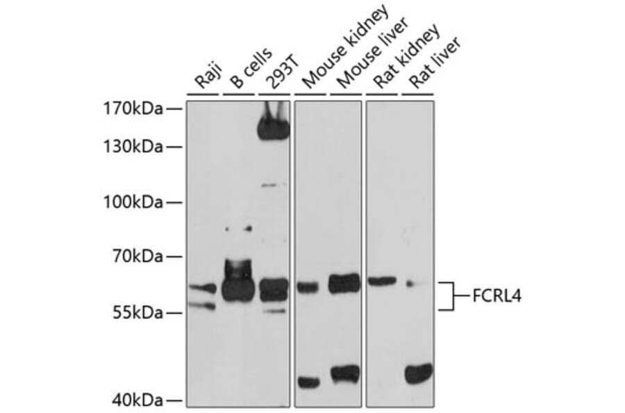 Western Blot - Anti-FCRL4 Antibody (A12895) - Antibodies.com