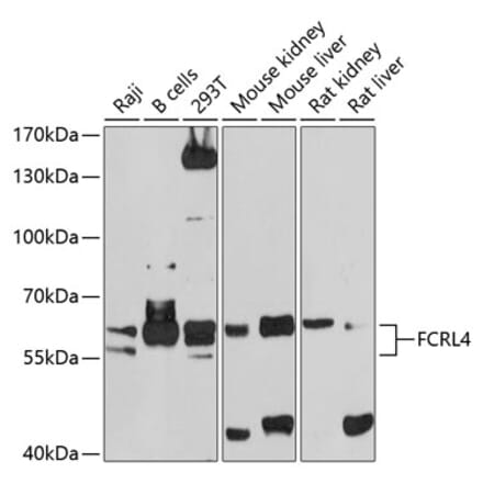 Western Blot - Anti-FCRL4 Antibody (A12895) - Antibodies.com