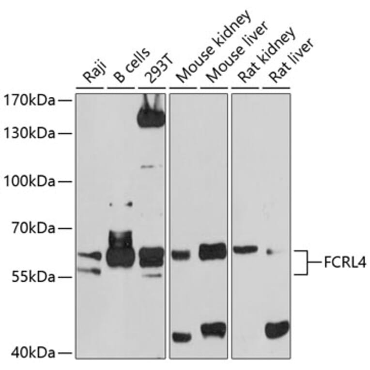 Western Blot - Anti-FCRL4 Antibody (A12895) - Antibodies.com