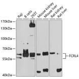 Western Blot - Anti-FCRL4 Antibody (A12895) - Antibodies.com