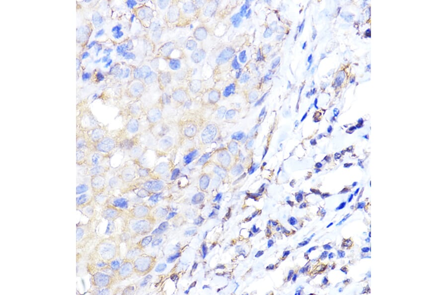 Immunohistochemistry - Anti-ENO1 Antibody (A12896) - Antibodies.com