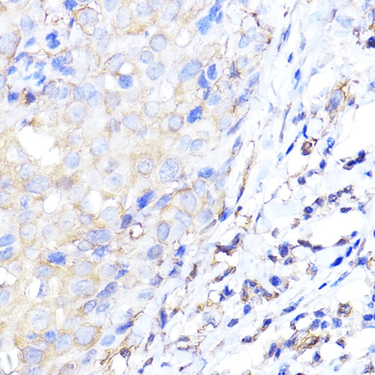 Immunohistochemistry - Anti-ENO1 Antibody (A12896) - Antibodies.com