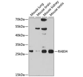 Western Blot - Anti-RAB34 Antibody (A12897) - Antibodies.com