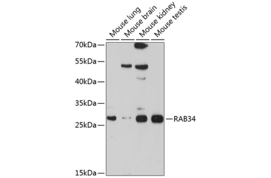 Western Blot - Anti-RAB34 Antibody (A12897) - Antibodies.com