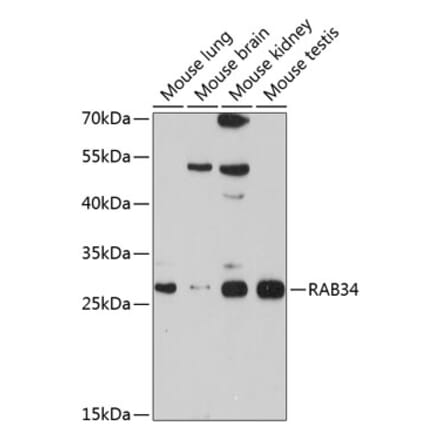 Western Blot - Anti-RAB34 Antibody (A12897) - Antibodies.com