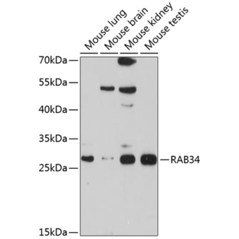 Western Blot - Anti-RAB34 Antibody (A12897) - Antibodies.com
