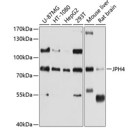 Western Blot - Anti-JP-4 Antibody (A12898) - Antibodies.com