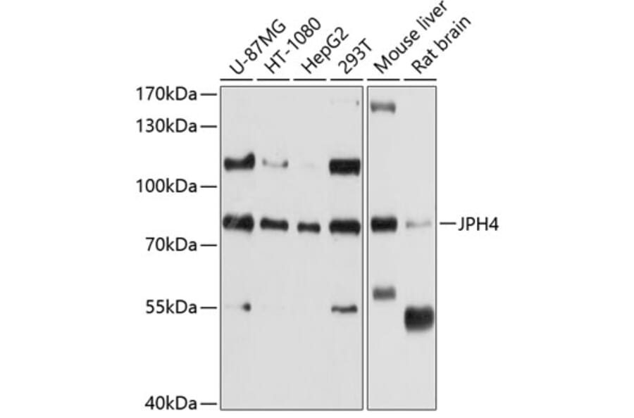 Western Blot - Anti-JP-4 Antibody (A12898) - Antibodies.com