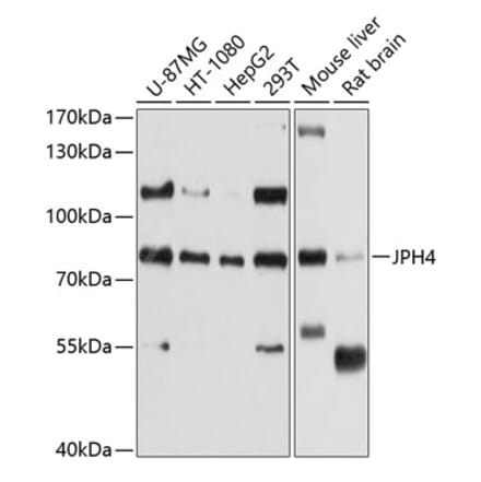 Western Blot - Anti-JP-4 Antibody (A12898) - Antibodies.com