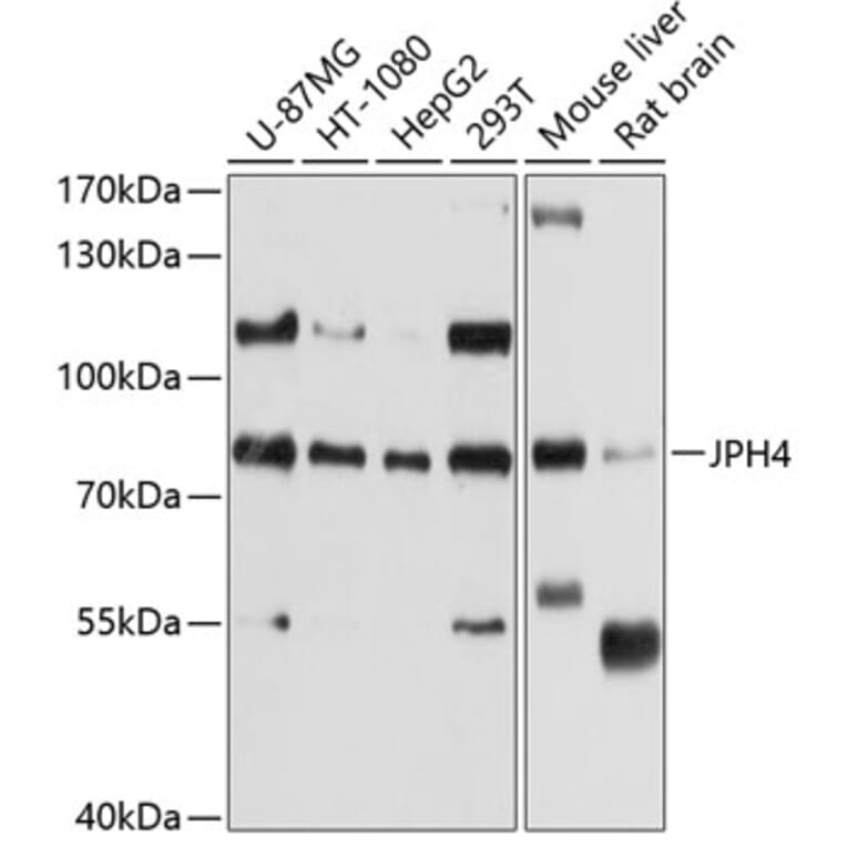 Western Blot - Anti-JP-4 Antibody (A12898) - Antibodies.com