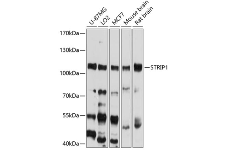 Western Blot - Anti-FAM40A Antibody (A12899) - Antibodies.com