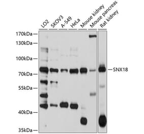Western Blot - Anti-SNX18 Antibody (A10337) - Antibodies.com