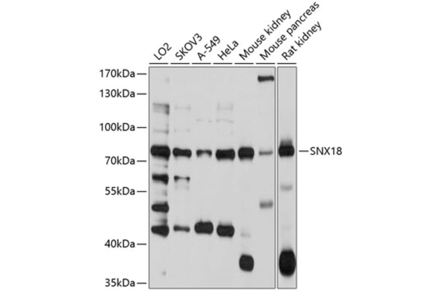 Western Blot - Anti-SNX18 Antibody (A10337) - Antibodies.com