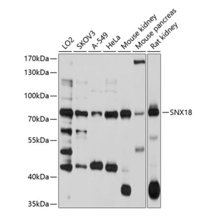 Western Blot - Anti-SNX18 Antibody (A12900) - Antibodies.com