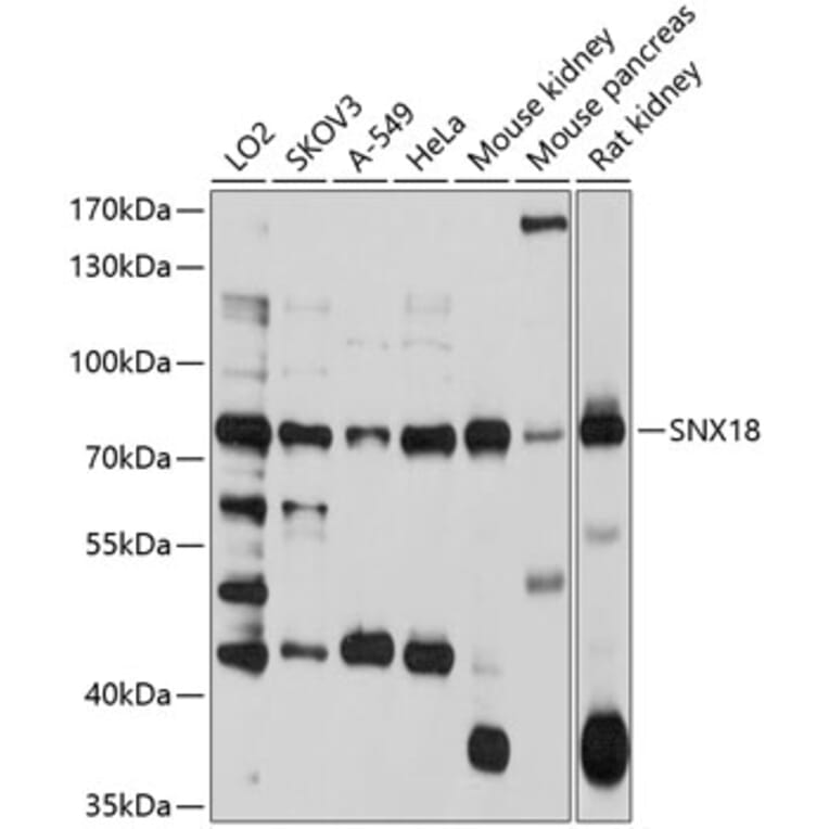 Western Blot - Anti-SNX18 Antibody (A10337) - Antibodies.com