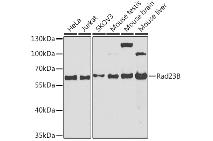 Western Blot - Anti-RAD23B Antibody (A12901) - Antibodies.com