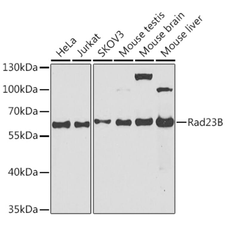 Western Blot - Anti-RAD23B Antibody (A12901) - Antibodies.com