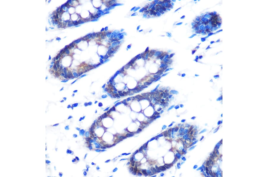 Immunohistochemistry - Anti-RAD23B Antibody (A12901) - Antibodies.com