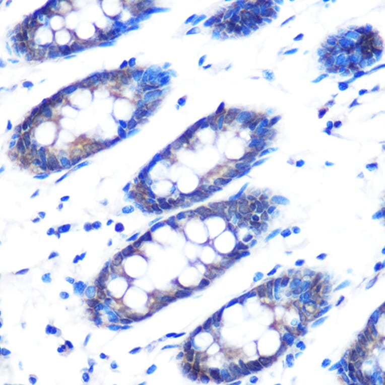 Immunohistochemistry - Anti-RAD23B Antibody (A12901) - Antibodies.com