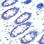 Immunohistochemistry - Anti-RAD23B Antibody (A12901) - Antibodies.com