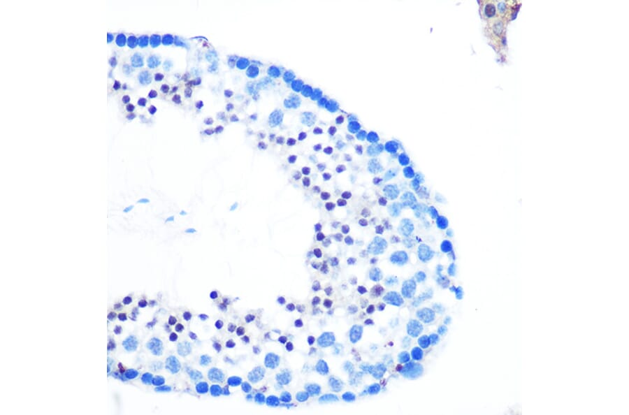 Immunohistochemistry - Anti-RAD23B Antibody (A12901) - Antibodies.com