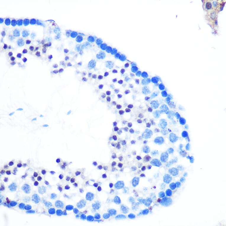 Immunohistochemistry - Anti-RAD23B Antibody (A12901) - Antibodies.com