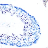 Immunohistochemistry - Anti-RAD23B Antibody (A12901) - Antibodies.com