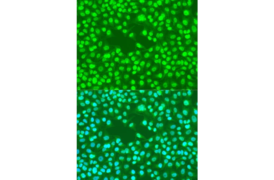 Immunofluorescence - Anti-RAD23B Antibody (A12901) - Antibodies.com