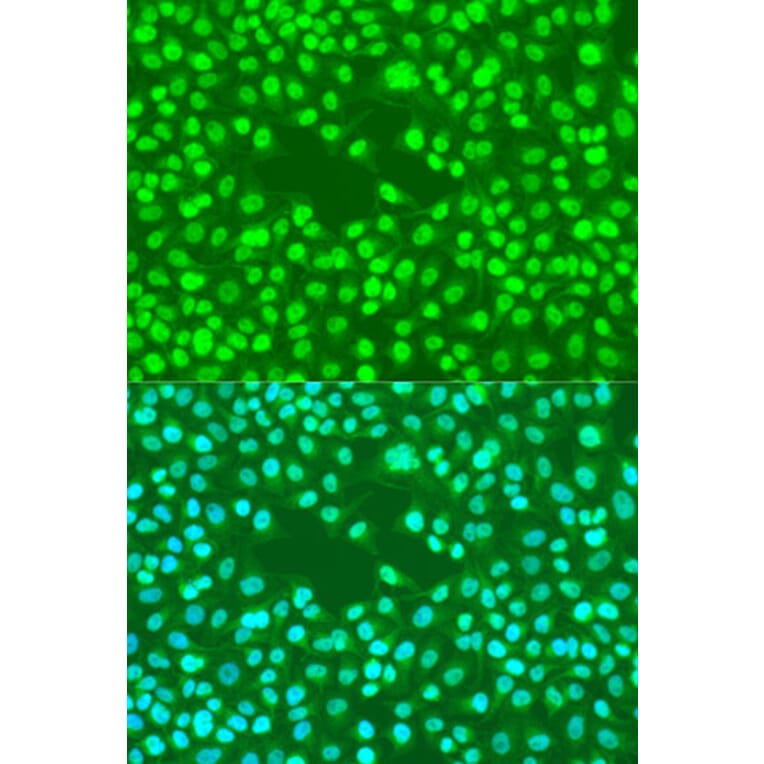 Immunofluorescence - Anti-RAD23B Antibody (A12901) - Antibodies.com