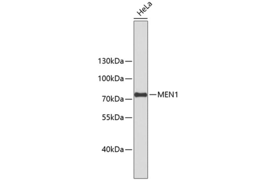 Western Blot - Anti-MEN1 Antibody (A10343) - Antibodies.com