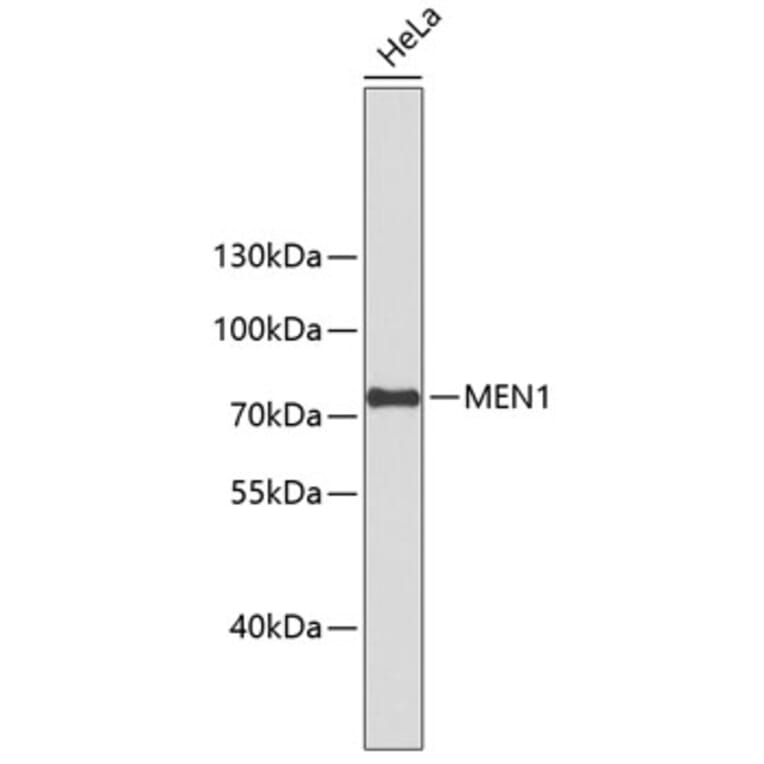 Western Blot - Anti-MEN1 Antibody (A10343) - Antibodies.com