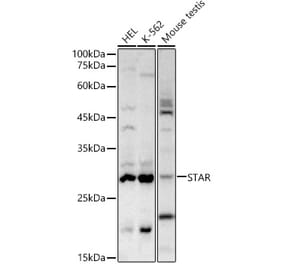 Western Blot - Anti-StAR Antibody (A12903) - Antibodies.com