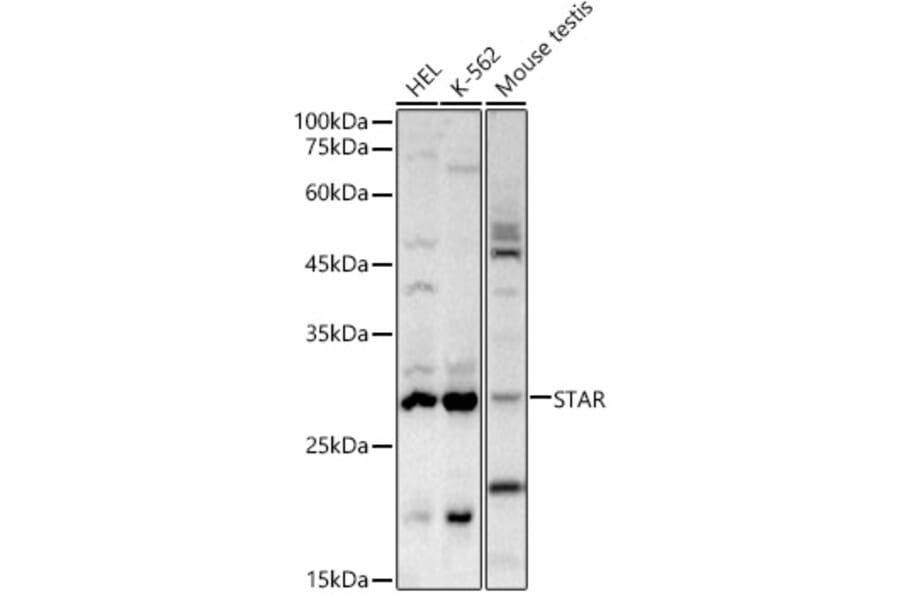Western Blot - Anti-StAR Antibody (A12903) - Antibodies.com