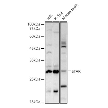 Western Blot - Anti-StAR Antibody (A12903) - Antibodies.com