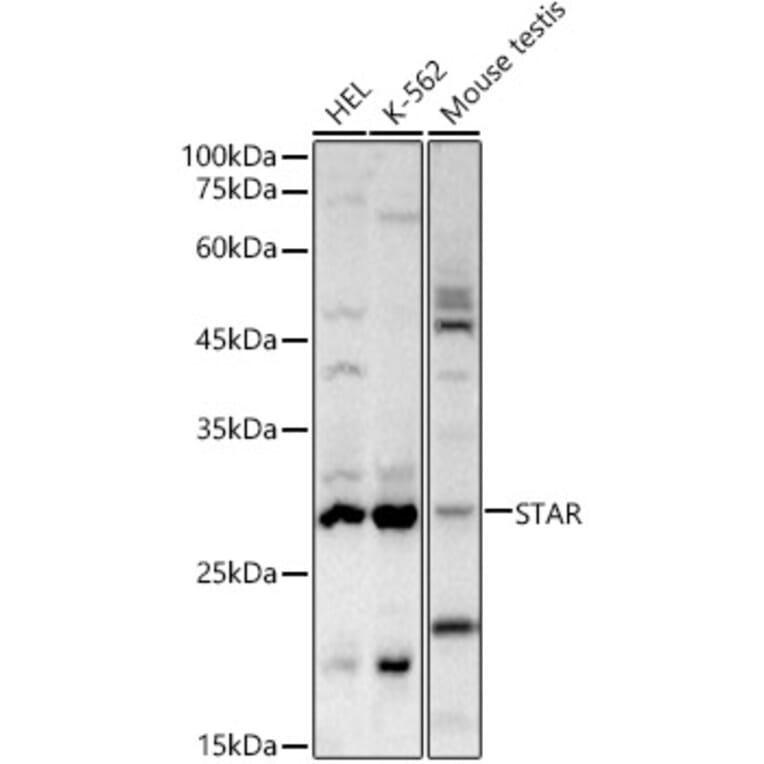 Western Blot - Anti-StAR Antibody (A12903) - Antibodies.com