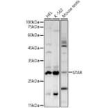 Western Blot - Anti-StAR Antibody (A12903) - Antibodies.com